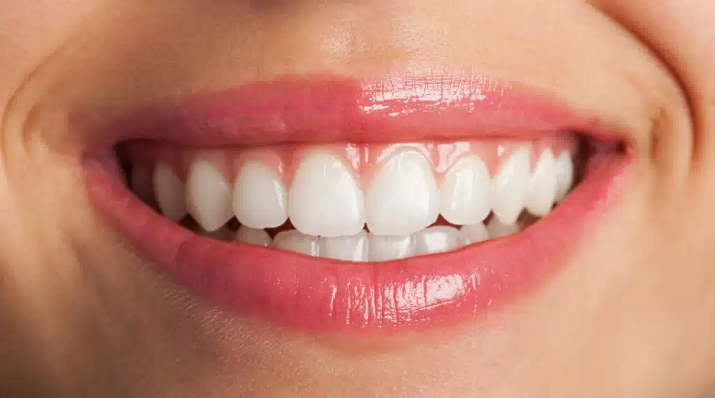 Transform Your Smile Makeover with Gum Contouring