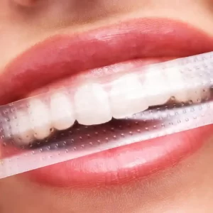 Should You Brush Before Whitening Strips