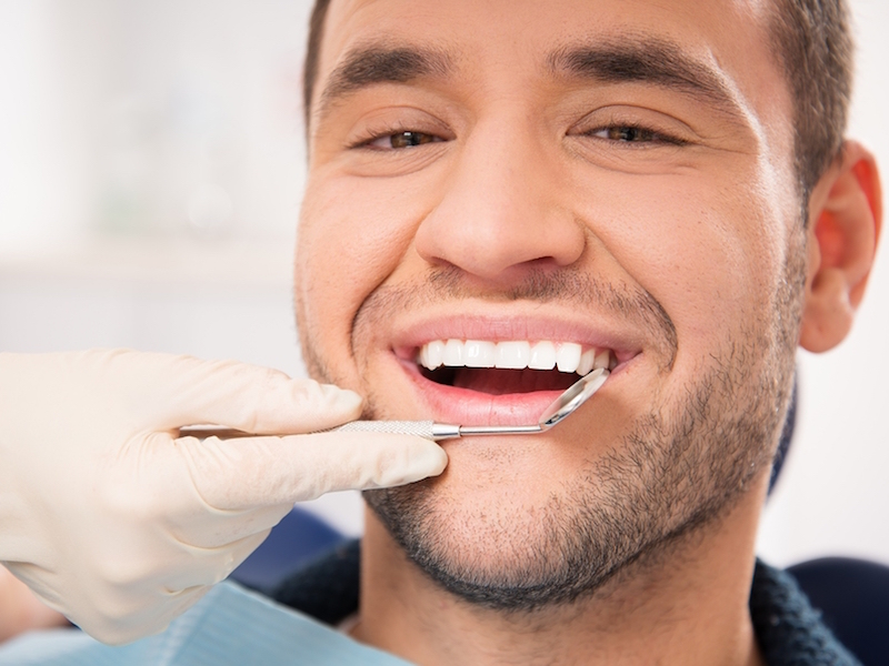 dental veneers longevity