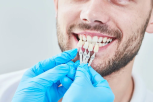 dental veneers longevity